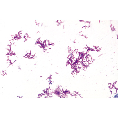Bakterien - Französisch, 1003885 [W13011F], Mikropräparate LIEDER