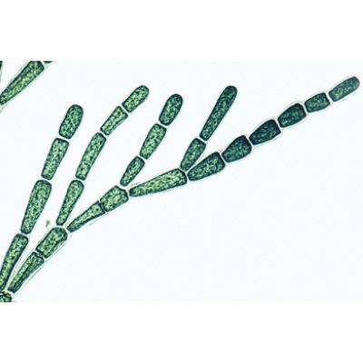 Algen (Algae) - Deutsch, 1003888 [W13012], Mikropräparate LIEDER