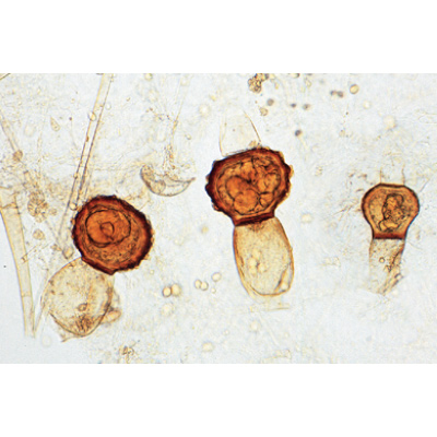 Pilze und Flechten (Fungi, Lichenes) - Deutsch, 1003892 [W13013], Mikropräparate LIEDER