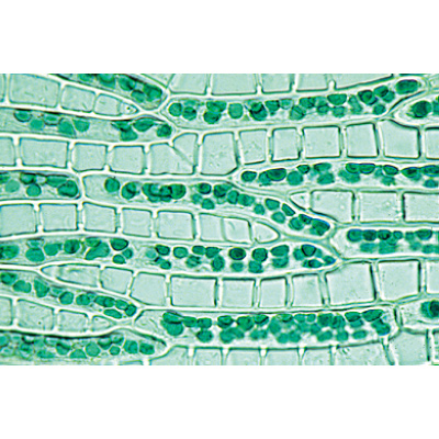 Moospflanzen (Bryophyta) - Deutsch, 1003896 [W13014], Mikropräparate LIEDER