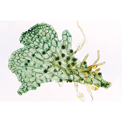 Farnpflanzen (Pteridophyta) - Deutsch, 1003900 [W13015], Mikropräparate LIEDER