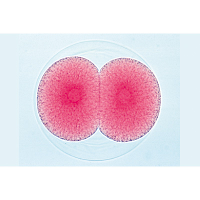 Entwicklung des Seeigels (Psammechinus miliaris) - Deutsch, 1003944 [W13026], Mikropräparate LIEDER