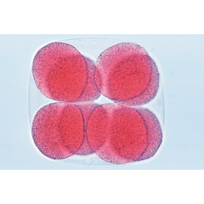 Entwicklung des Seeigels (Psammechinus miliaris) - Deutsch, 1003944 [W13026], Mikropräparate LIEDER