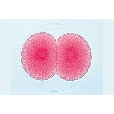 Entwicklung des Seeigels (Psammechinus miliaris) - Französisch, 1003945 [W13026F], Mikropräparate LIEDER