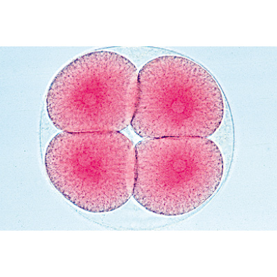 Entwicklung des Seeigels (Psammechinus miliaris) - Französisch, 1003945 [W13026F], Mikropräparate LIEDER