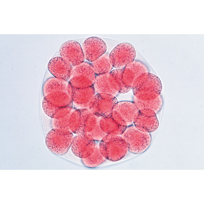 Entwicklung des Seeigels (Psammechinus miliaris) - Portugiesisch, 1003946 [W13026P], Mikropräparate LIEDER