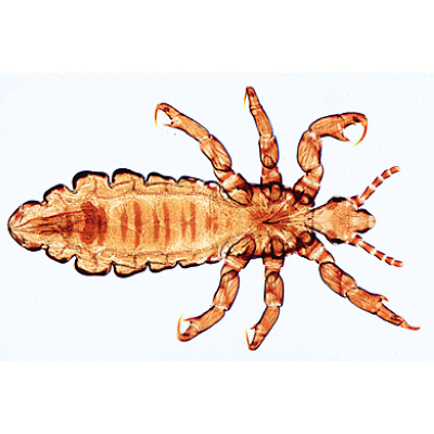 Insekten (Insecta) - Englisch, 1003965 [W13035], Mikropräparate LIEDER