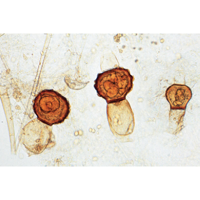 Pilze und Flechten (Fungi, Lichenes) - Englisch, 1003971 [W13042], Mikropräparate LIEDER