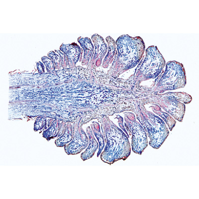 Blütenpflanzen I. Nacktsamer (Gymnospermae) - Englisch, 1003974 [W13045], Mikropräparate LIEDER