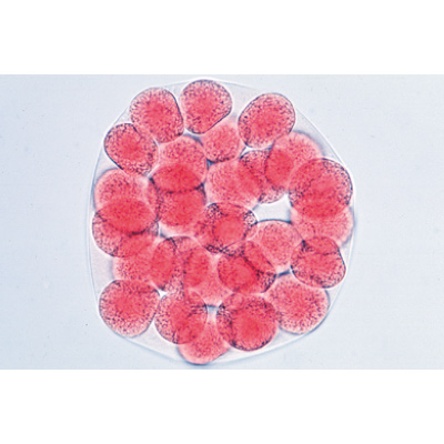 Entwicklung des Seeigels (Psammechinus miliaris) - Englisch, 1003984 [W13055], Mikropräparate LIEDER