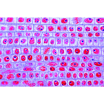 Mitose und Meiose Serie II, 1013472 [W13080], Pflanzliche Zelle