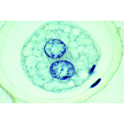 Eireifung und Befruchtung beim Pferdespulwurm (Ascaris megalocephala), 1013478 [W13084], Parasitologie