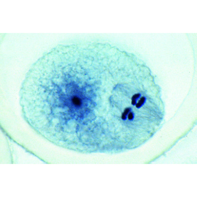 The Ascaris megalocephala Embryology - French, 1013480 [W13085], Zellteilung