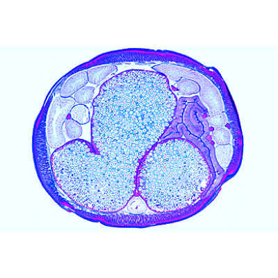 The Ascaris megalocephala Embryology - Portuguese, 1013482 [W13087], Mikropräparate LIEDER