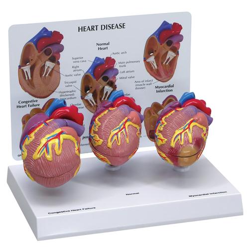 3-Mini-Herzmodell-Set, 1019530 [W33365], Herz- und Kreislaufmodelle