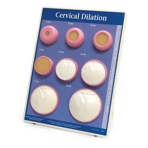 Cervical Dilation Easel Display, 1012488 [W43093], Schwangerschaft und Geburt