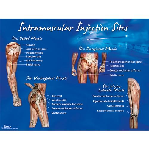 Intramuscular Injection Sites Poster, 1018427 [W44783], Injektionen und Punktion