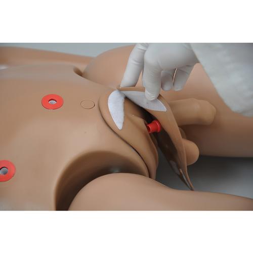 Klinische CHLOE ™ Patient Care Simulator mit geformten Magen, 1017542 [W45052], Stoma Versorgung
