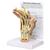 Handmodell mit rheumatoider Arthritis, 1019521, Hand- und Armskelett Modelle (Small)