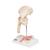 Hüftgelenkmodell mit Oberschenkelbruch & Hüftgelenkverschleiß - 3B Smart Anatomy, 1000175 [A88], Gelenkmodelle (Small)