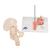 Hüftgelenkmodell mit Oberschenkelbruch & Hüftgelenkverschleiß - 3B Smart Anatomy, 1000175 [A88], Arthritis und Osteoporose (Small)