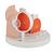 Pathologisches Augenmodell - 3B Smart Anatomy, 1017230 [F17], Augenmodelle (Small)