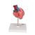 Herzmodell "Klassik" mit Bypass, 2-teilig - 3B Smart Anatomy, 1017837 [G05], Herzgesundheit und Fitnesserziehung (Small)