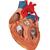 Herzmodell mit Bypass, 2-fache Größe, 4-teilig - 3B Smart Anatomy, 1000263 [G06], Herz- und Kreislaufmodelle (Small)