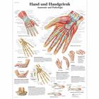 Lehrtafel - Hand und Handgelenk - Anatomie und Pathologie, 1001318 [VR0171L], Skelettsystem
