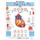 Lehrtafel - Herzinfarkt, 4006597 [VR0342UU], Herz-Kreislauf-System