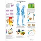 Lehrtafel - Osteoporosis, 1001472 [VR1121L], Skelettsystem
