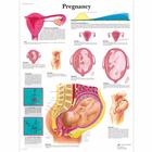 Lehrtafel - Pregnancy, 1001572 [VR1554L], Schwangerschaft und Geburt
