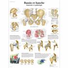 Lehrtafel - Bassin et hache - Anatomie et pathologie, 4006742 [VR2172UU], Skelettsystem