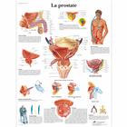 Lehrtafel - La prostate, 1001733 [VR2528L], Harnsystem
