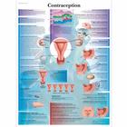 Lehrtafel - Contraception, 4006790 [VR2591UU], Schwangerschaft und Geburt
