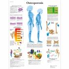 Lehrtafel - Osteoporosis, 1001803 [VR3121L], Arthritis und Osteoporose