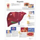 Lehrtafel - Hepatitis, 4006856 [VR3435UU], Stoffwechselsystem