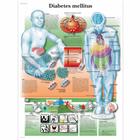 Lehrtafel - Diabetes mellitus, 4006857 [VR3441UU], Stoffwechselsystem