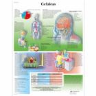 Lehrtafel - Cefaleas, 4006881 [VR3714UU], Gehirn und Nervensystem
