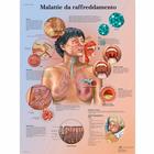 Lehrtafel - Malattie da raffreddamento, 4006918 [VR4253UU], Atmungssystem
