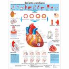Lehrtafel - Infarto cardiaco, 4006927 [VR4342UU], Herzgesundheit und Fitnesserziehung