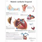 Lehrtafel - Malattie cardiache frequenti, 1002027 [VR4343L], Herzgesundheit und Fitnesserziehung