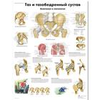 Медицинский плакат "Таз и тазобедренный сустав, анатомия и патология", 1002228 [VR6172L], Skelettsystem