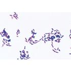 Bakterien als Krankheits- und Seuchenerreger - Deutsch, 1004146 [W13324], Mikropräparate