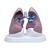 Lungen-Set mit Pathologien, 1018749 [W33371], Lungenmodelle (Small)